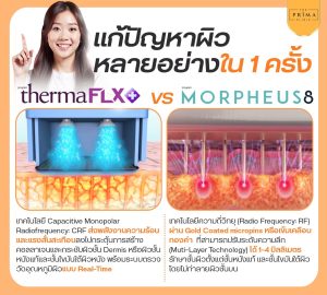 เทอร์มาจ มอเฟียส ต่างกัน