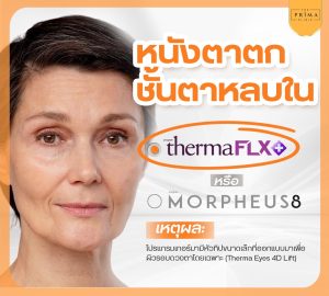 หนังตาตก ชั้นตาหลบใน