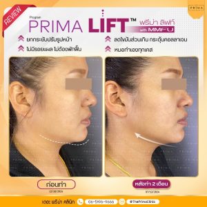 รีวิว MMFU (2)