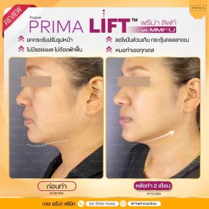 รีวิว MMFU (4)