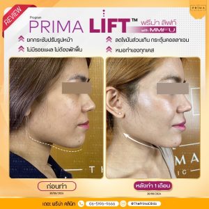 รีวิว MMFU (6)