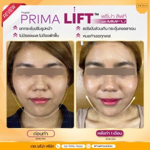 รีวิว MMFU (8)