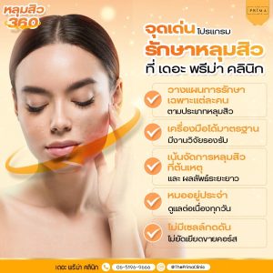จุดเด่น หลุมสิว 360
