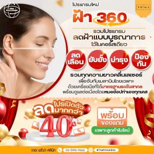 ฝ้า 360