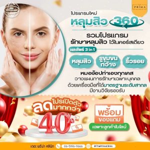 หลุมสิว 360
