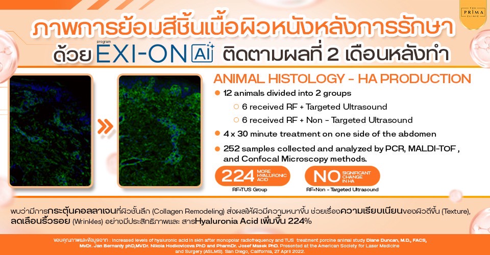 exion ช่วยเรื่องอะไร