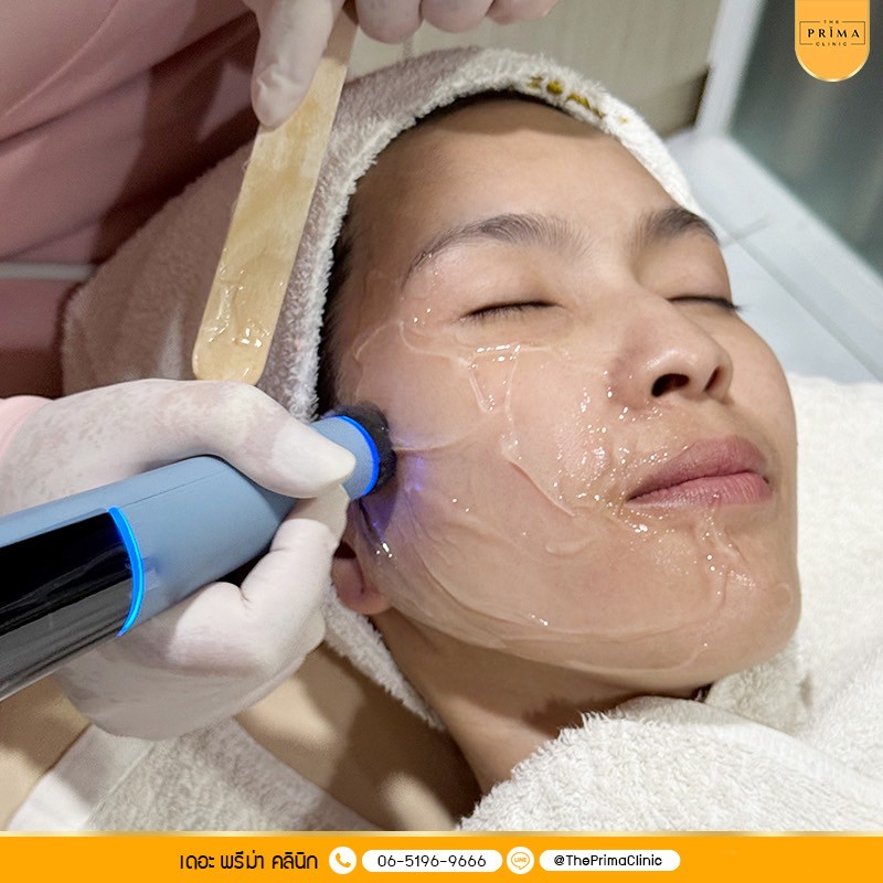 Exion ขั้นตอน (4)