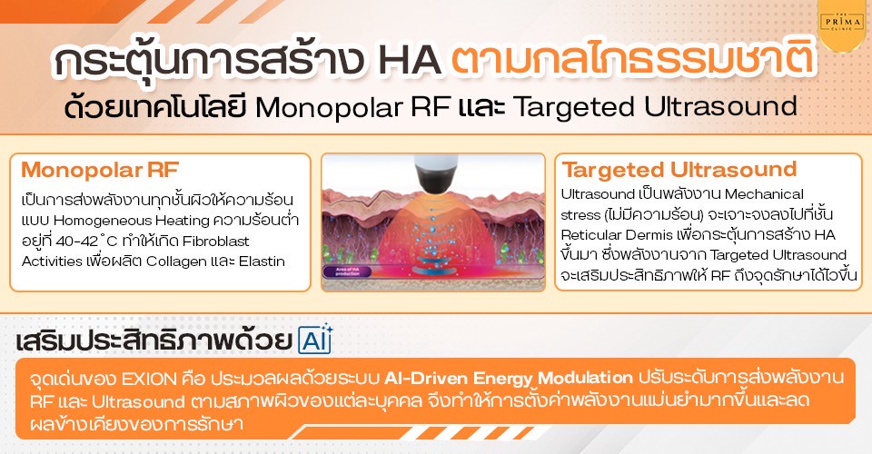 exion คืออะไร