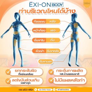 Exion body ทำจุดไหนได้บ้าง