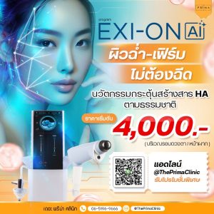 Exion ราคา โปรโมชั่น