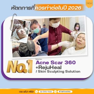 หัตถการรักษาหลุมสิว ปี 2026