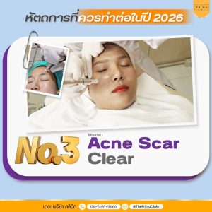 หัตถการรักษาหลุมสิว ปี 2026