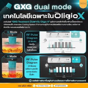 Oligio X GXG dual mode