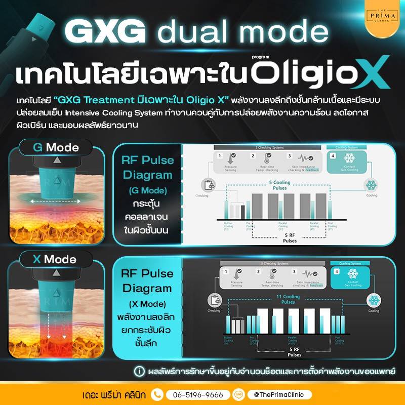Oligio X GXG dual mode