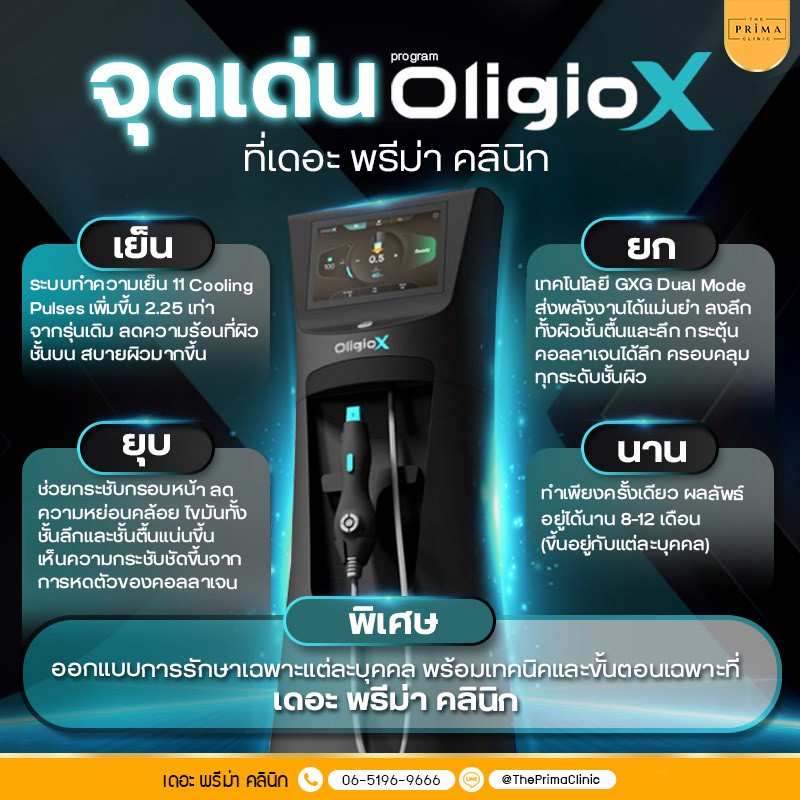 Oligio X จุดเด่น