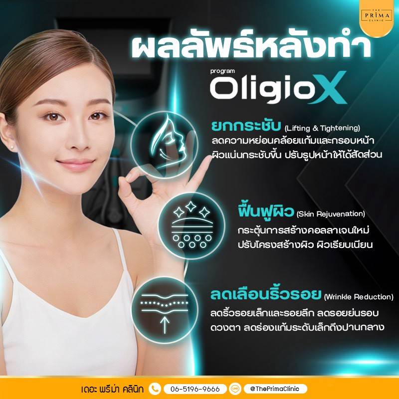 Oligio X ผลลัพธ์หลังทำ ดีอย่างไร