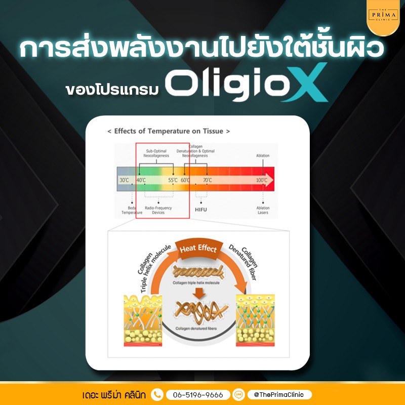 Oligio X หลักการทำงาน