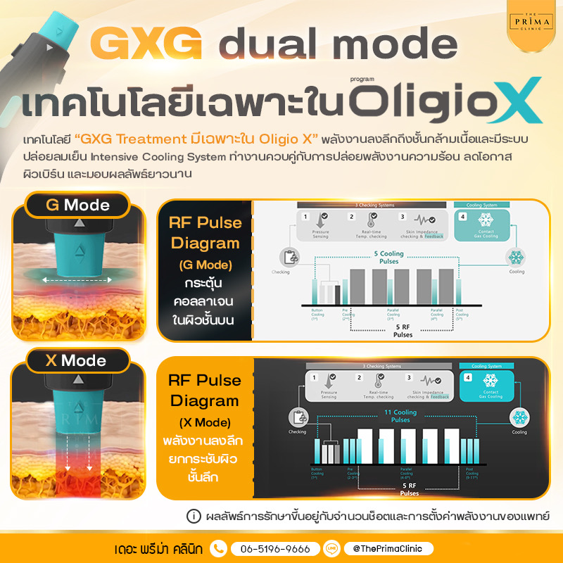 Infographic about GXG dual mode technology, showing G Mode and X Mode with RF pulse diagrams and cooling details.