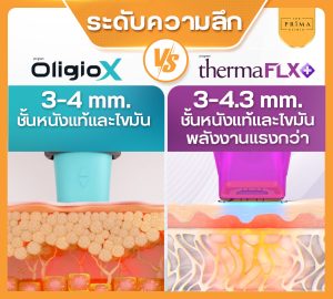 Infographic comparing OligioX and ThermaFLX devices; skin cross-sections show 3–4 mm vs 3–4.3 mm depth at left and right panels.