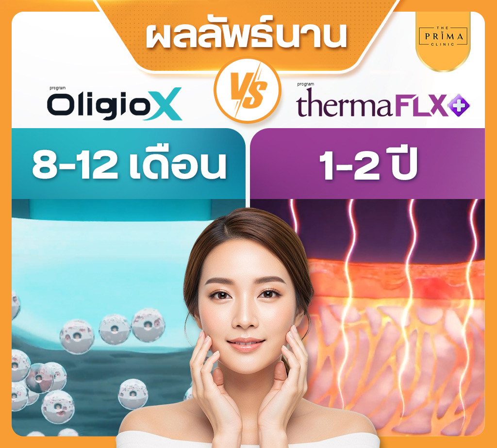Advertisement banner comparing OligioX vs ThermaFLX with 8–12 months and 1–2 years timelines; smiling woman in foreground.