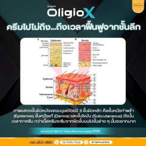 ผิวหย่อนคล้อยเพราะอะไร