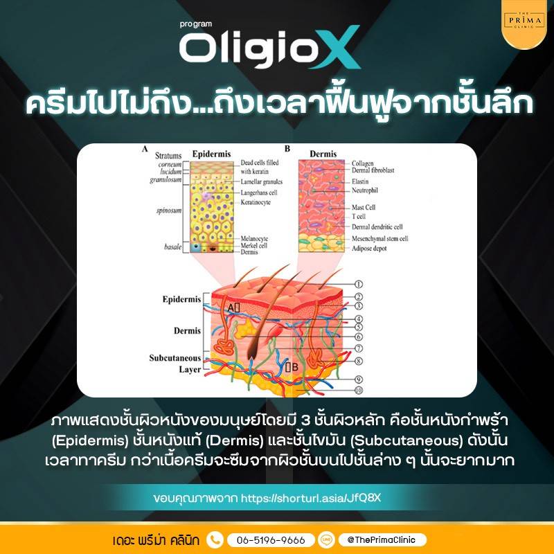 ผิวหย่อนคล้อยเพราะอะไร