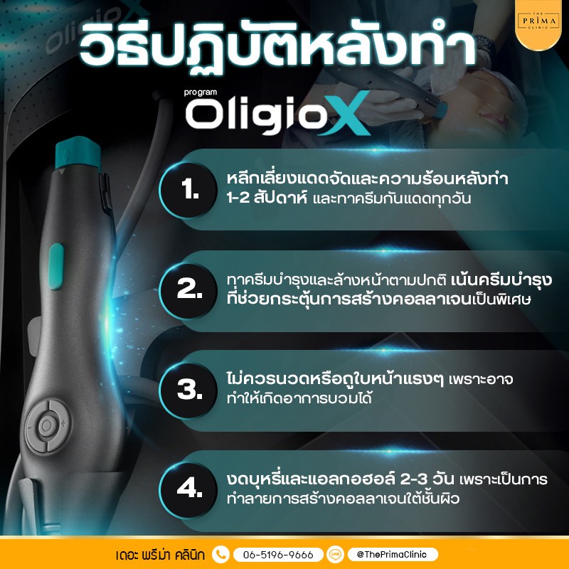วิธีปฏิบัติตัวหลังทำ Oligio X