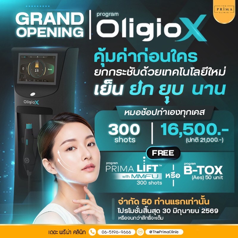 Grand opening poster for the OligioX program at The Prima Clinic, featuring a cosmetic device and a model with Thai promotional text and pricing details (300 shots for 16,500).