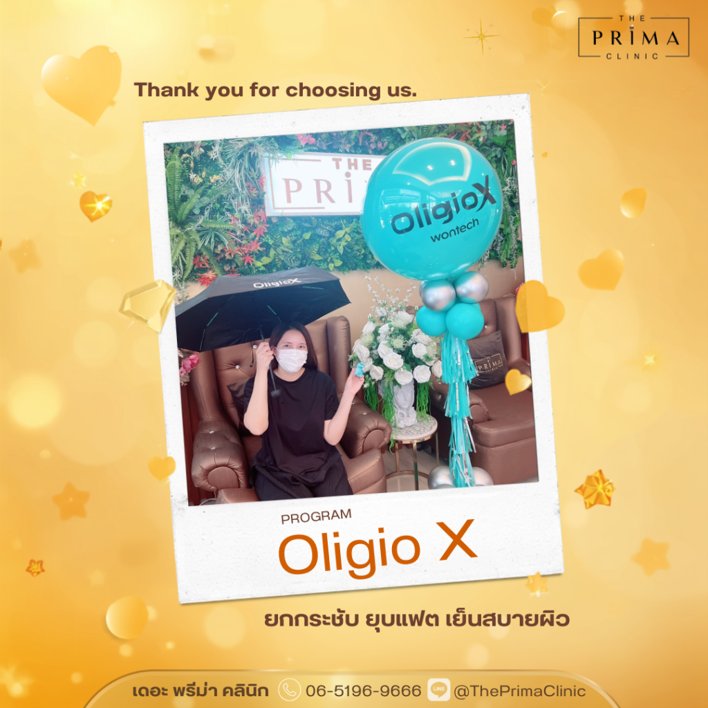 รีวิว OligioX