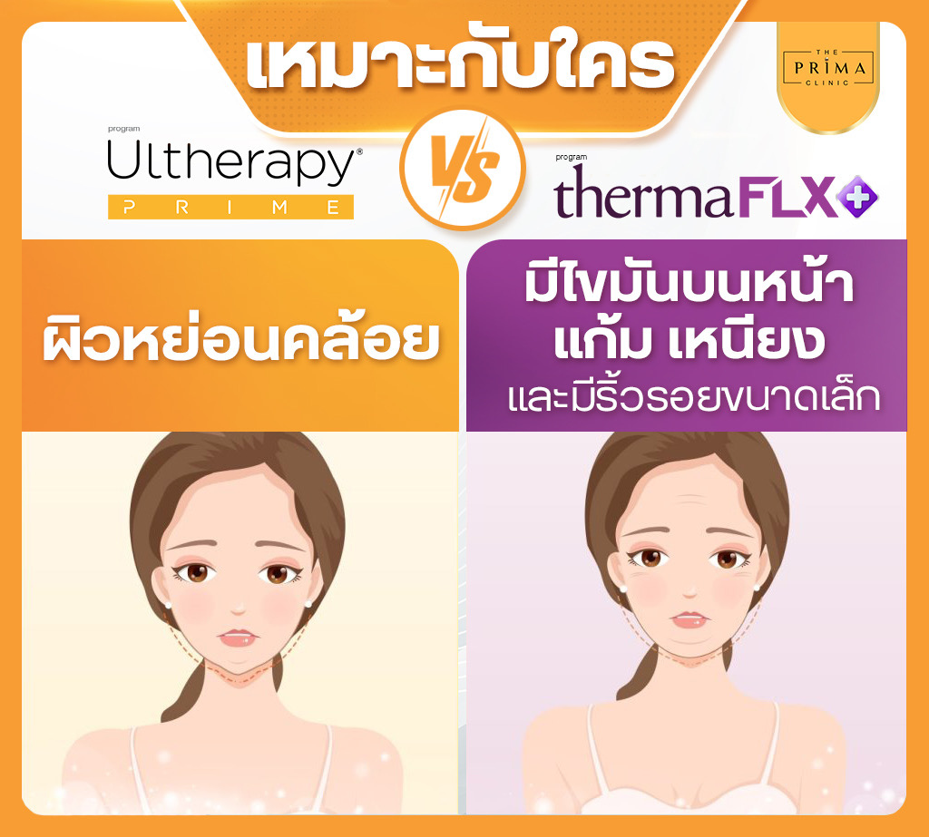 Ulthera Prime vs Thermage FLX (12)