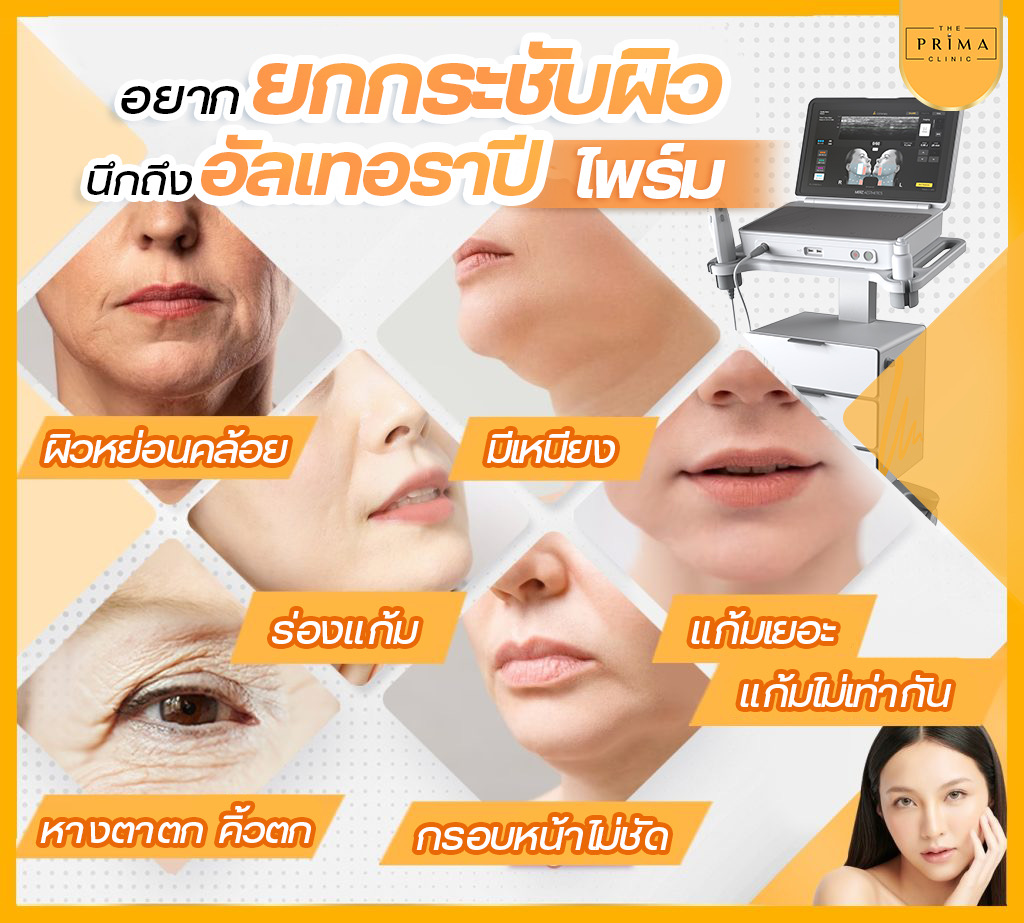 Ulthera Prime vs Thermage FLX (2)
