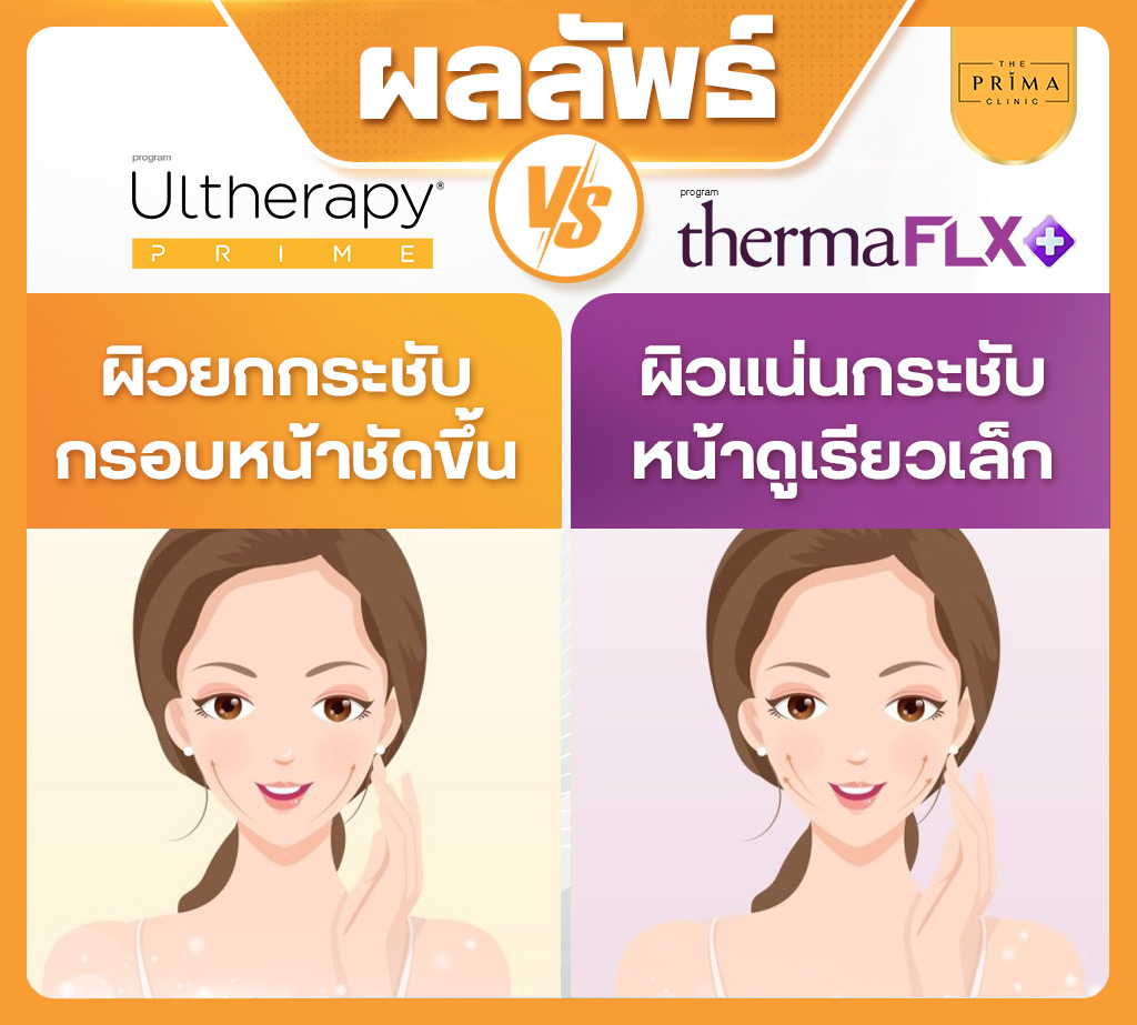 Ulthera Prime vs Thermage FLX (3)