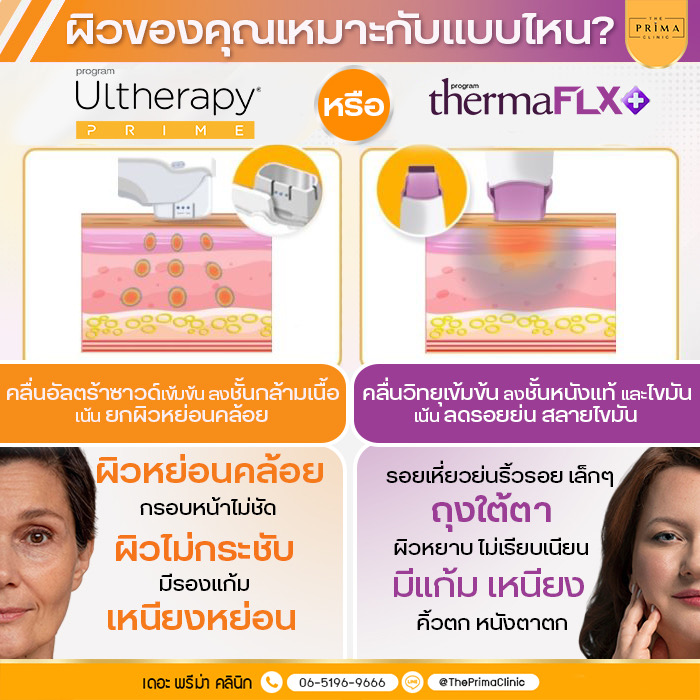 Ulthera Prime vs Thermage FLX (5)