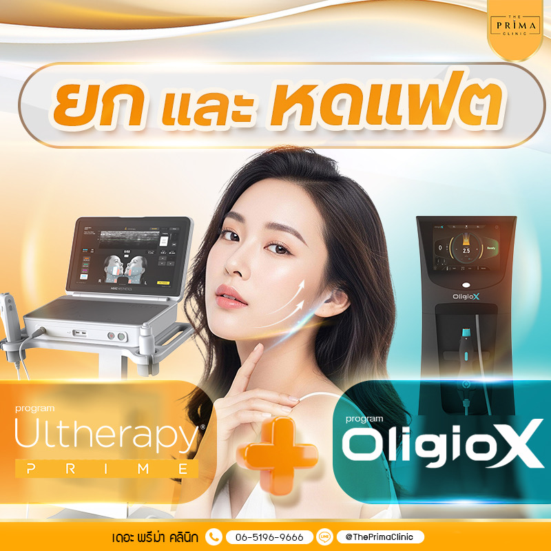 Advertisement for The Prima Clinic promoting Ultherapy Prime and OlgioX treatments, showing a woman with cosmetic devices in a clinic setting.