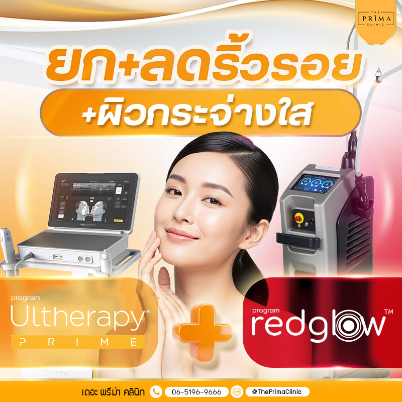 Thai ad banner for wrinkle lifting and brighter skin, featuring a smiling woman with Ultherapy Prime and RedGlow logos and medical devices in the background.