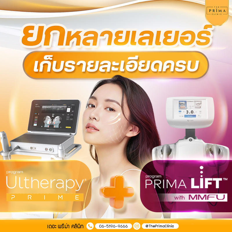 Thai clinic ad promoting non-surgical facial lifting with Ultherapy Prime and Prima Lift, featuring a woman and aesthetic devices in a bright gradient banner. (Top Thai text conveyed: a lifting and detail-completion message)