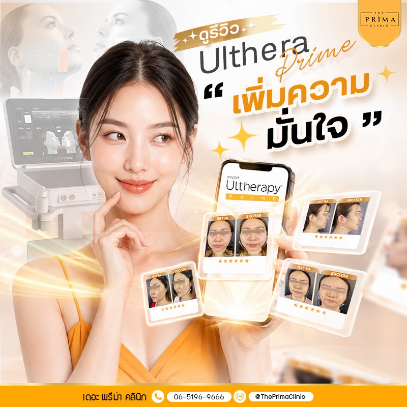 Smiling woman holds Ultherapy result cards in a bright clinic ad for Ulthera Prime.