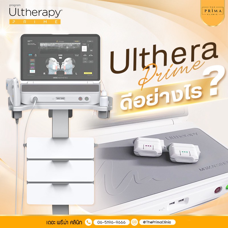 Ultherapy Prime aesthetic device on a stand with touchscreen interface, used for non-surgical facial lifting in a clinic.