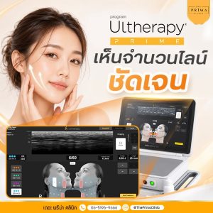 Promotional image for Ultherapy Prime featuring a smiling woman beside the Ultherapy device and its screen.🌟
