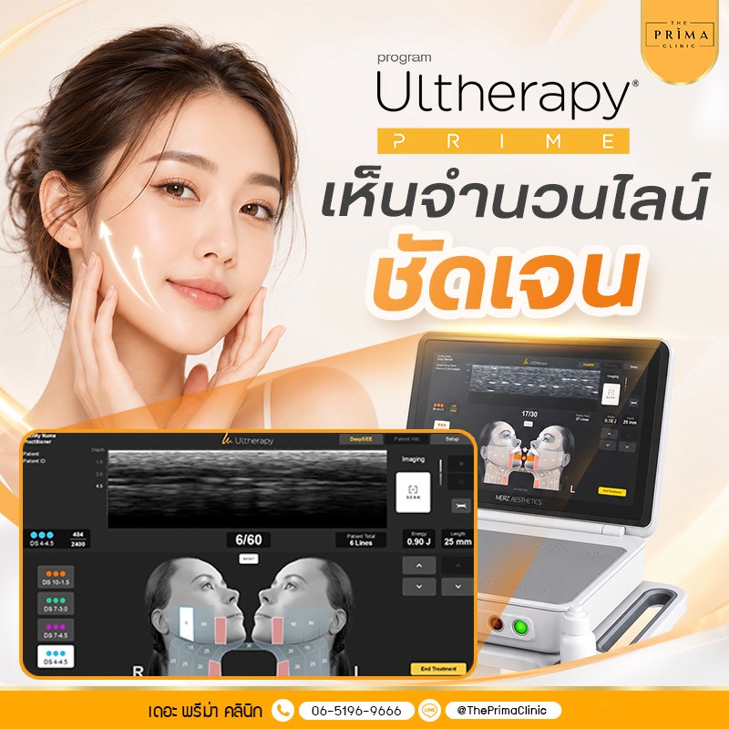 Promotional image for Ultherapy Prime featuring a smiling woman beside the Ultherapy device and its screen.🌟