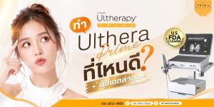 Woman touching her temple on a promotional banner for Ultherapy Prime, with the device image and FDA-cleared badge on the right.